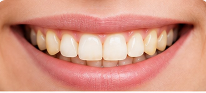 Manchas en los dientes
